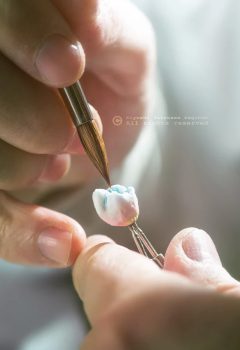 Is Having a Gum Lift Really Necessary for Your Oral Health?