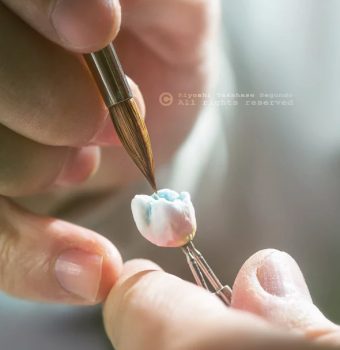 Is Having a Gum Lift Really Necessary for Your Oral Health?