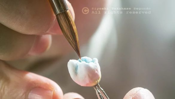 Is Having a Gum Lift Really Necessary for Your Oral Health?