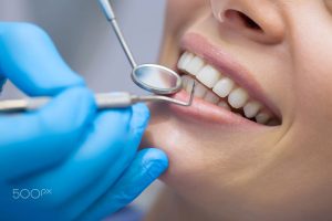 Little-Known Services that Your Dentists are Providing