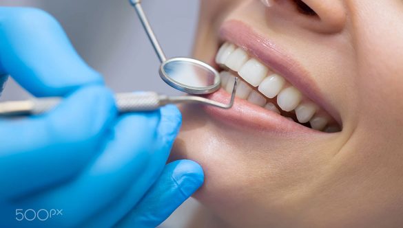 Little-Known Services that Your Dentists are Providing