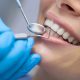 Little-Known Services that Your Dentists are Providing